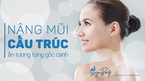 Nâng mũi Cấu trúc